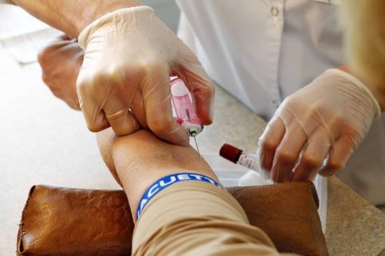 Bendras kraujo tyrimas gali nustatyti ligą